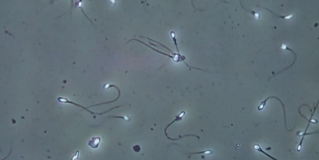 Watoto 200 Wazaliwa na Mbegu za Jeni ya Saratani